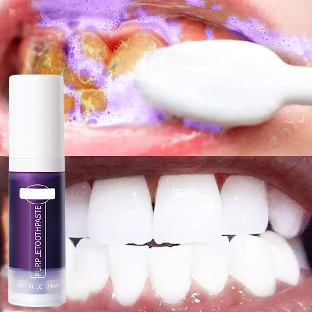 Purple Whitening Toothpaste – 5D Pro-Grade Color-Correcting Teeth Whitening Toothpaste & Fresh Breath Oral Care