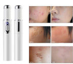 Scar Removal Phototherapy Pen – Asia’s Best-Selling Expert-Recommended Device for Fading Old Scars & Stretch Marks