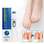Antifungal Laser Device - Nail Fungus Treatment Pen Anti-fungal Repair Pen Blue Light Laser Pen