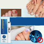 Antifungal Laser Device - Nail Fungus Treatment Pen Anti-fungal Repair Pen Blue Light Laser Pen