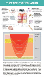 Cold Light Handheld Laser Therapy Device