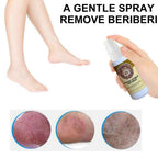 Fungal Treatment Foot Spray