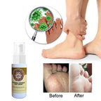 Fungal Treatment Foot Spray