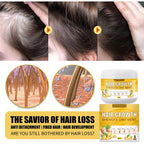 Ginger Hair Growth Cream – Natural Hair Loss Treatment