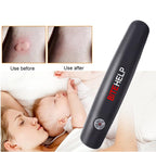 Insect Bite Suction - Instant Mosquito Bite Relief