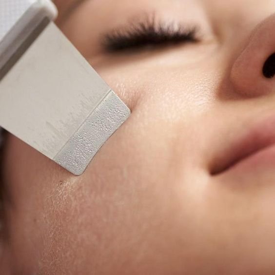 Ultrasonic Skin Scrubber - Blackhead Remover Tools for Facial Deep Cleansing